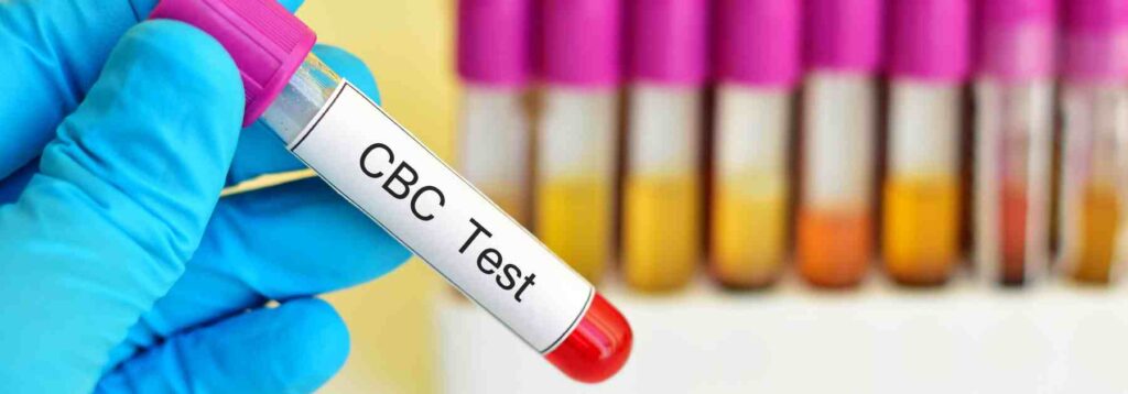 Complete blood count testing in Fermanagh.